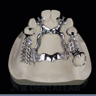 Che sensazione dà la corona in zirconia Upcera in bocca?