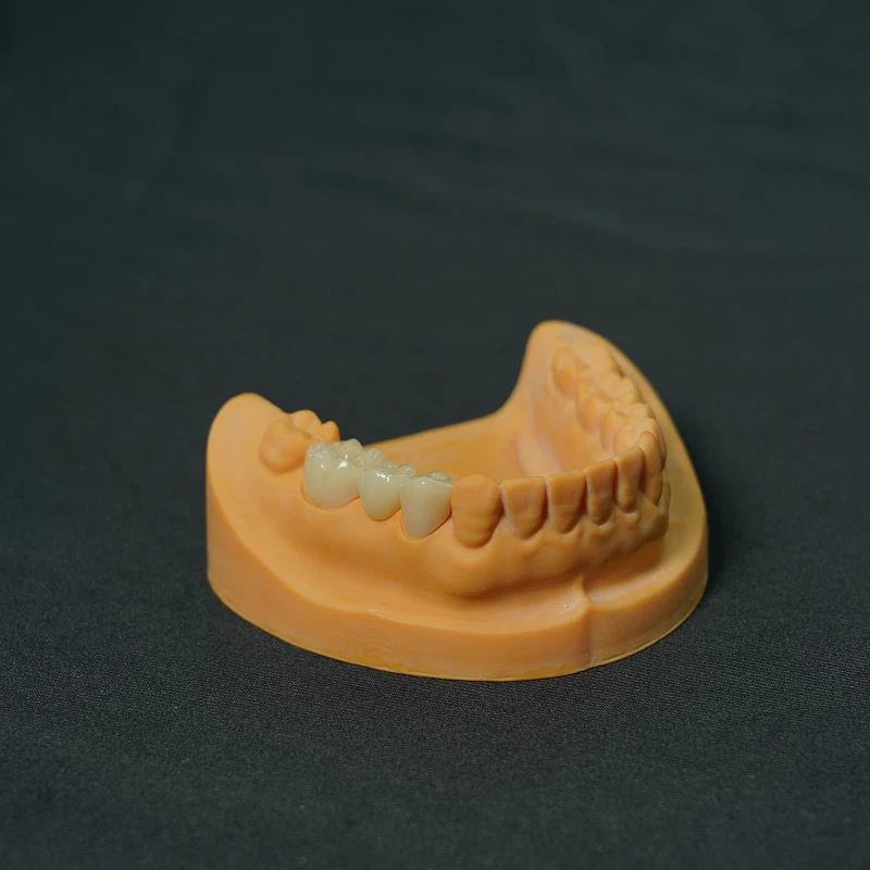 Upcera Zirconia Crown