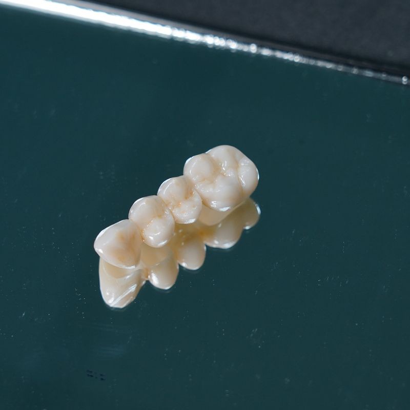 Wieland Zirconia Porcelain Teeth