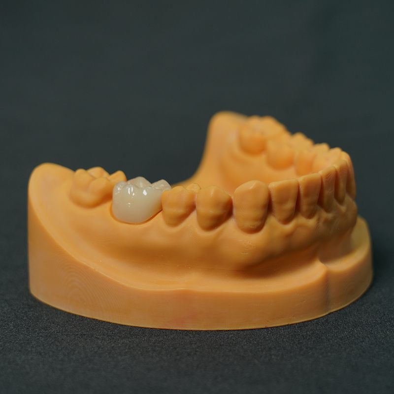 Zirconia Inner Crown Porcelain Finished